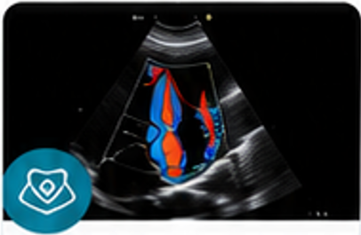 Diagnostic Echocardiography