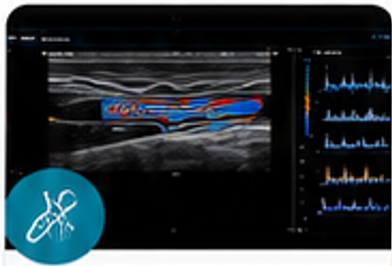 Diagnostic Vascular Ultrasound