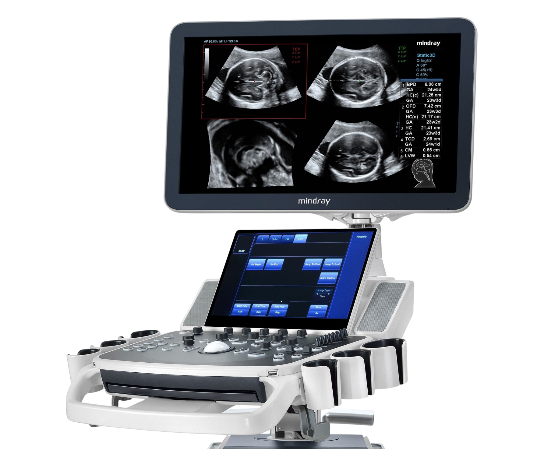 Ultrasound machine