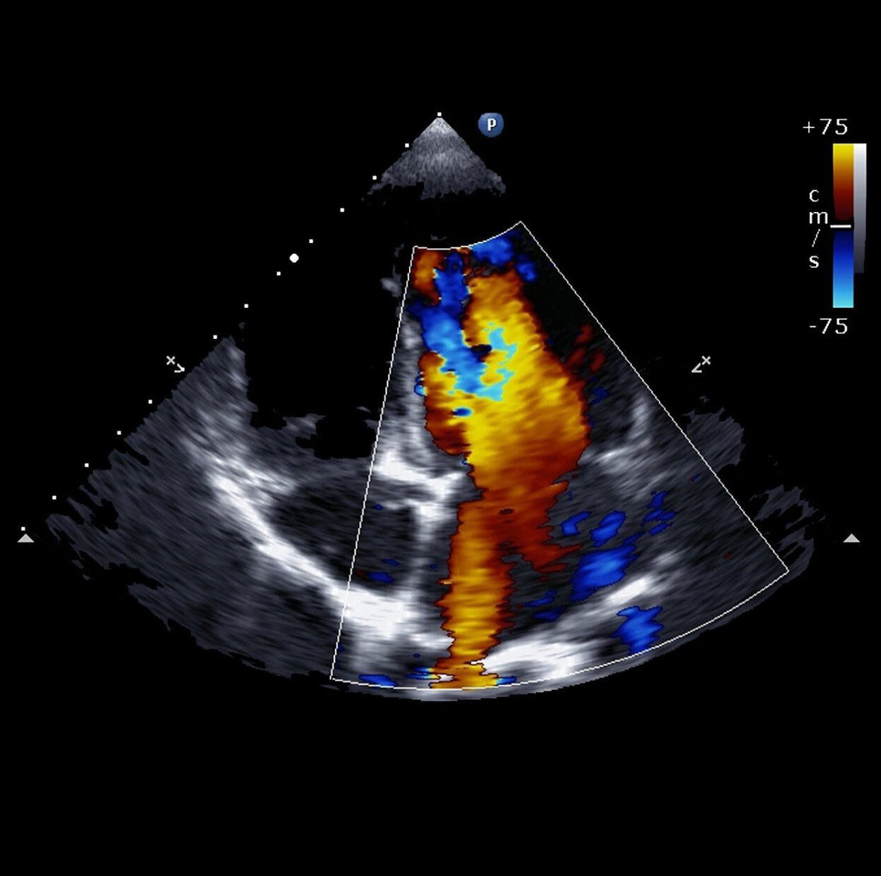 Echocardiography
