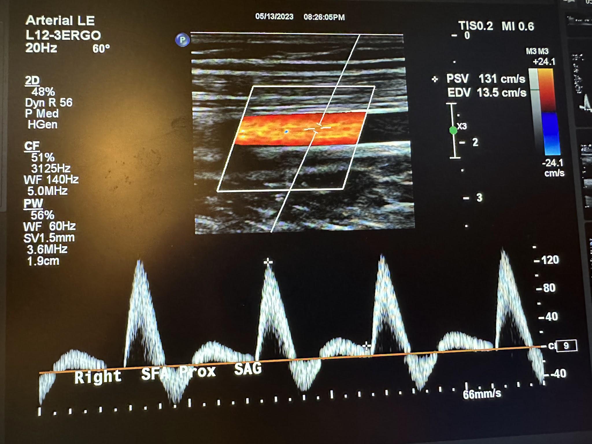 Home Screen Image 2 Vascular Image