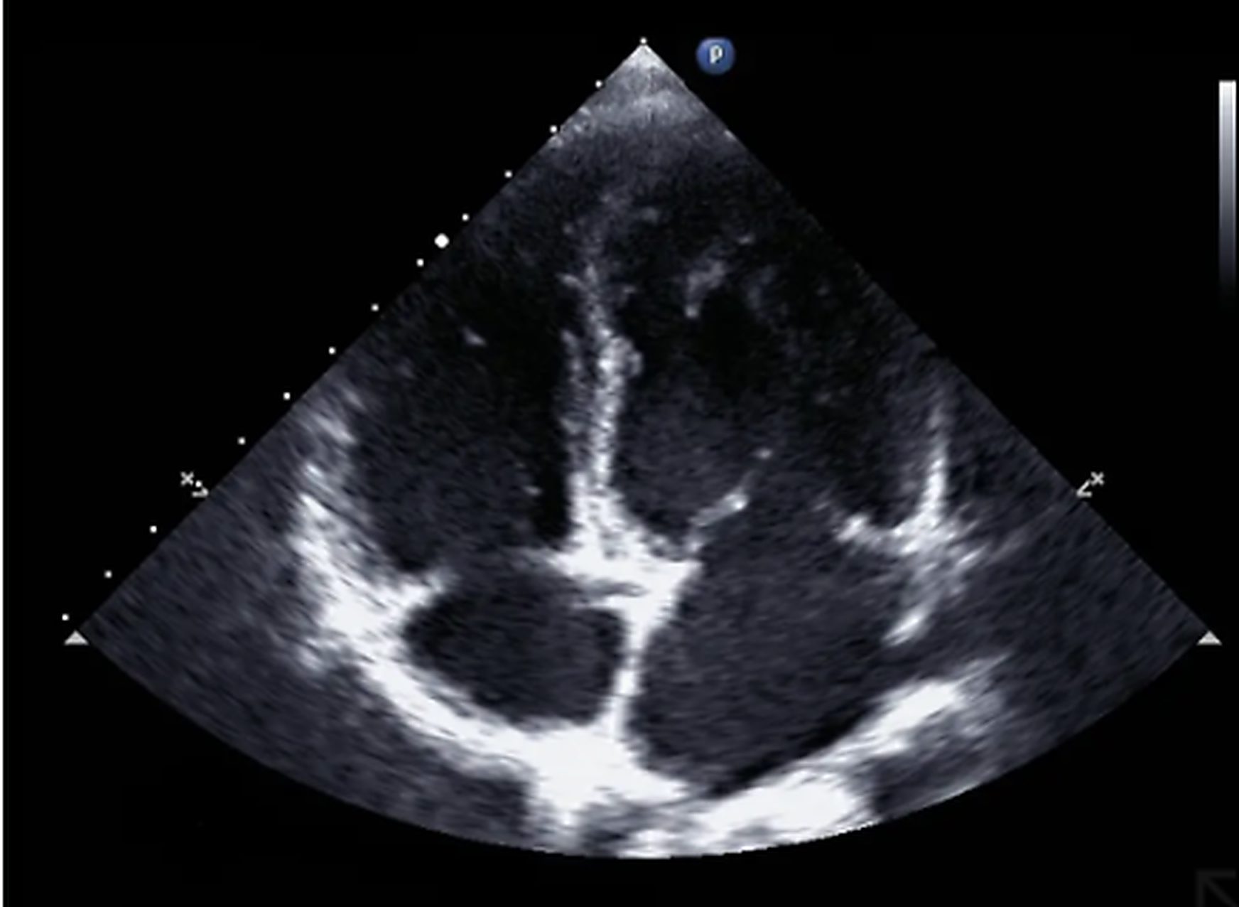 Diagnostic Echocardiography