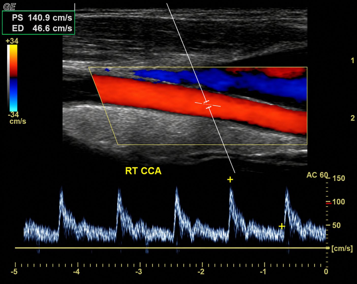 Diagnostic Vascular Ultrasound
